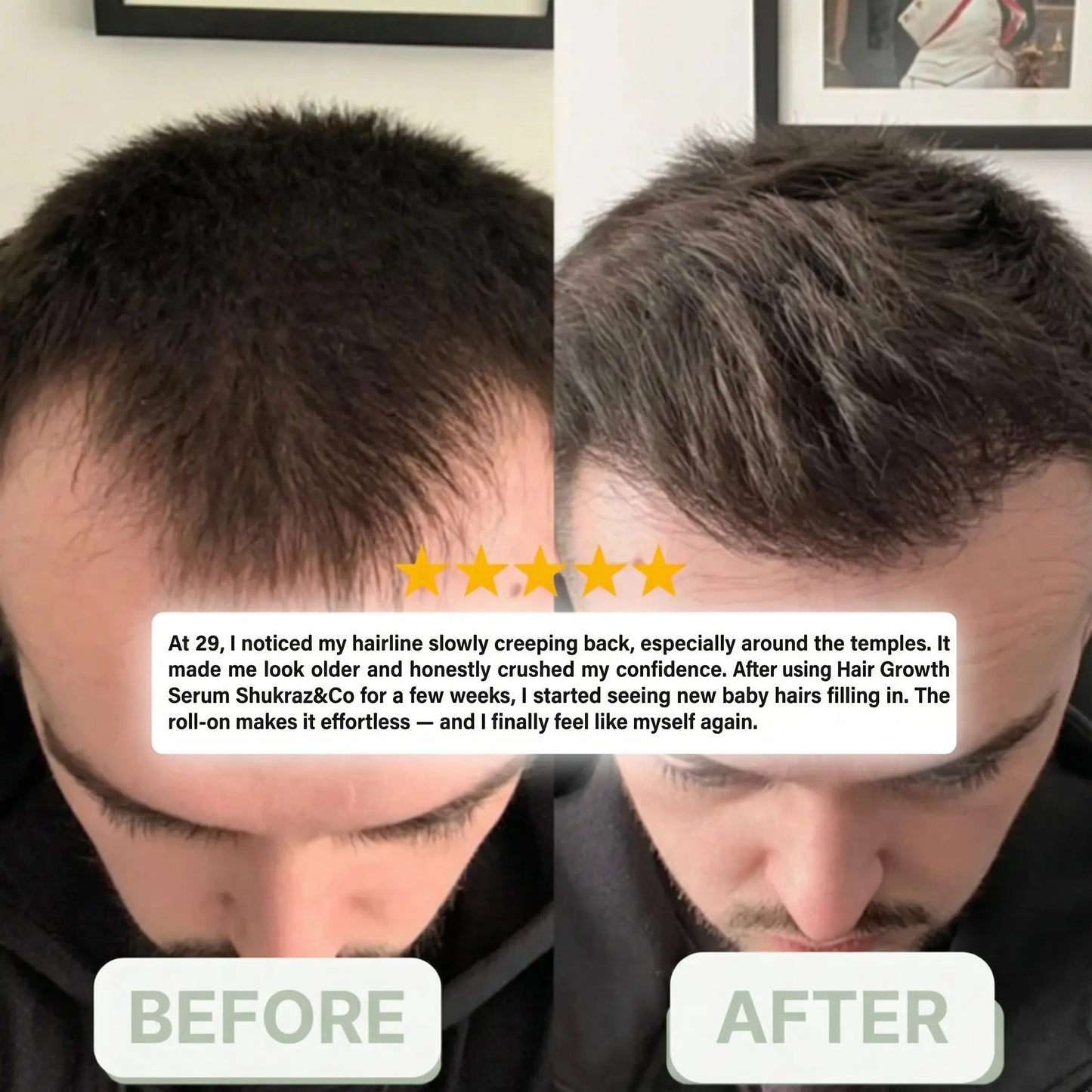 Shukraz&Co | Hair Growth Serum Roll-On