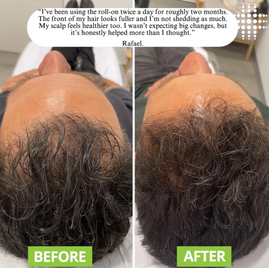 Shukraz&Co | Hair Growth Serum Roll-On