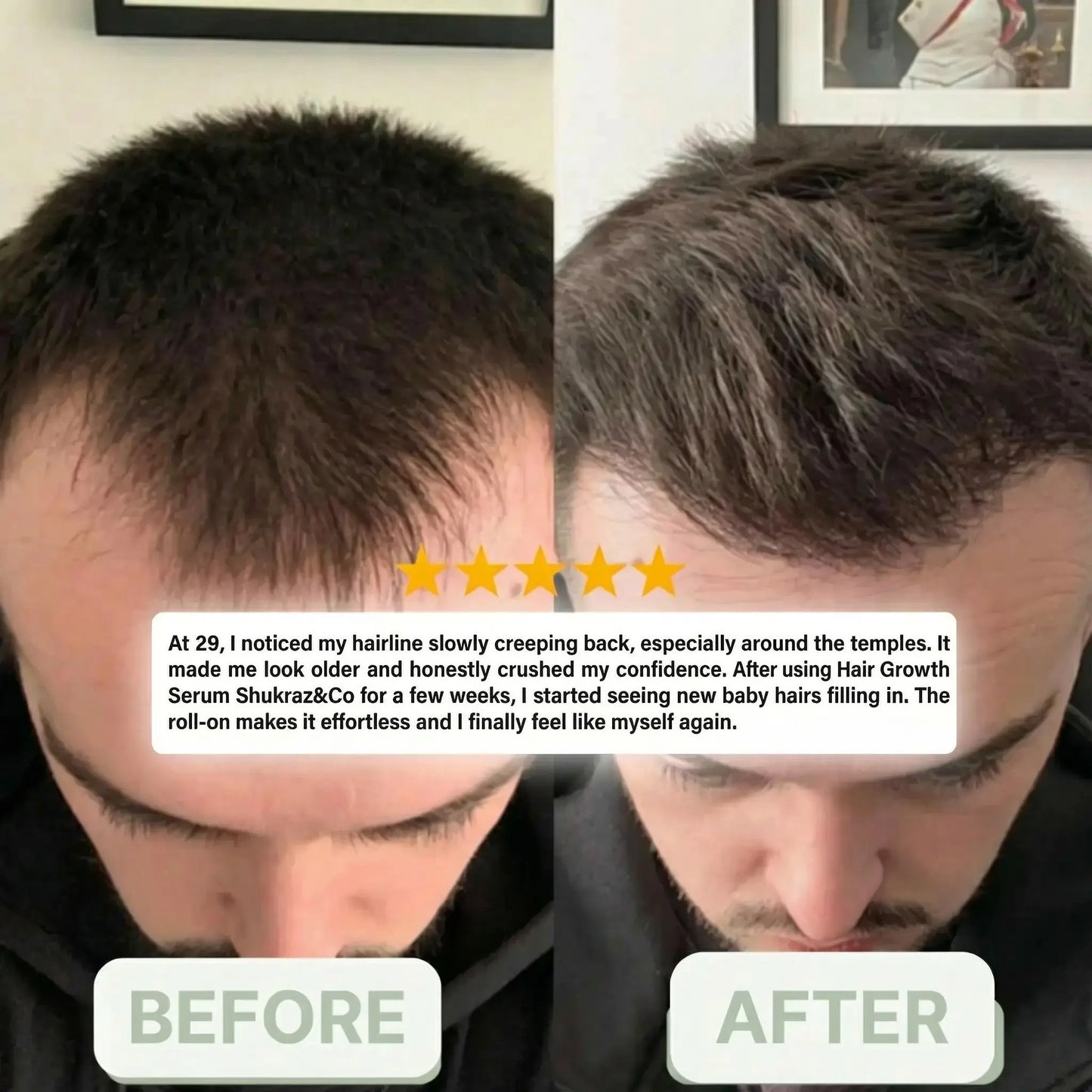 Shukraz&Co | Hair Growth Serum Roll-on