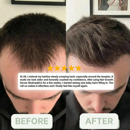 Shukraz&Co | Hair Growth Serum Roll-on